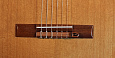 KNA NG-1